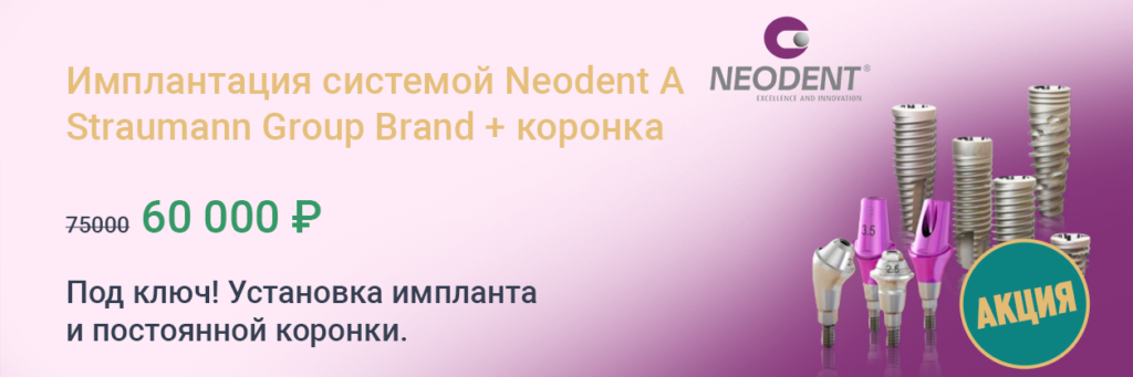 Имплантация neodent